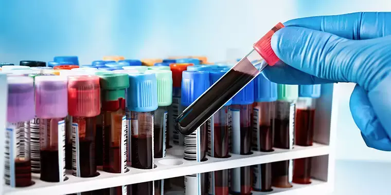 Canlı Kan Analizi Nedir? Cellavia Klinik Değerlendirme Rehberi Görsel