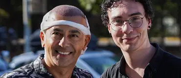 Saç ekimini herkese gönül rahatlığıyla tavsiye edebilirim Görsel